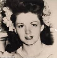 Những ca phẫu thuật thẩm mỹ thất bại của showbiz: Từ nổi tiếng đến biểu tượng thảm họa-3