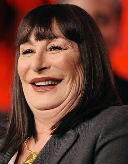 Những ca phẫu thuật thẩm mỹ thất bại của showbiz: Từ nổi tiếng đến biểu tượng thảm họa-6