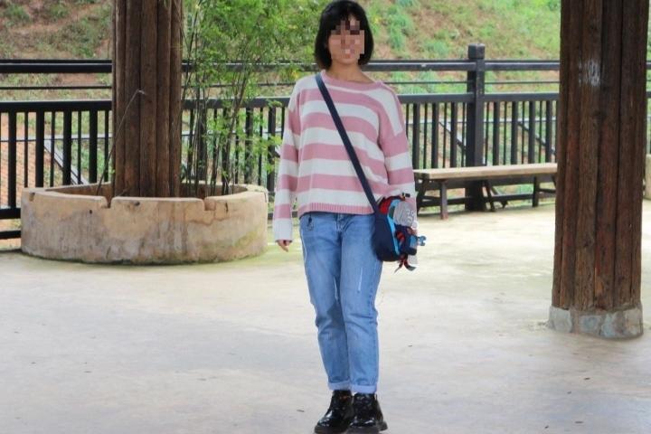 Cô gái Hà Nội chi 230 triệu đồng kéo dài chân thêm 7cm-1