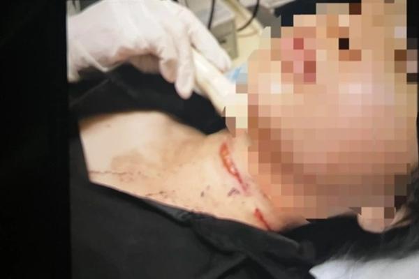 Tự gây thương tích rồi trình báo bị cướp cắt cổ lấy vàng và tiền-1