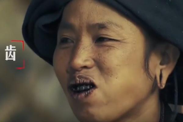 Bật mí 5 bí quyết làm trắng răng tại nhà hiệu quả-6