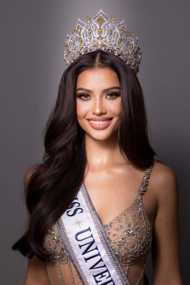 Tân Hoa hậu Hoàn vũ Thái Lan lộ ảnh cũ, nhan sắc thay đổi chóng mặt-4