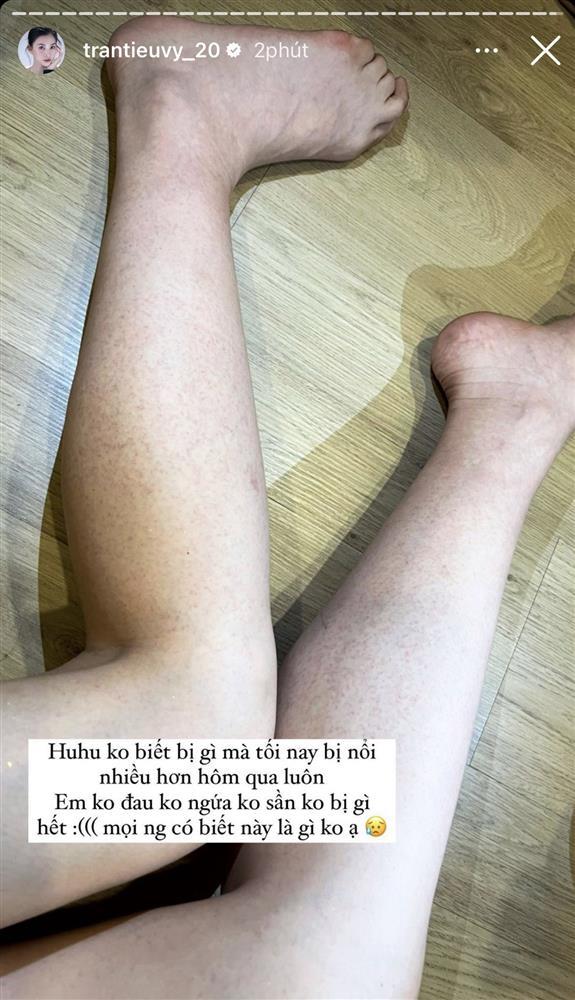 Đỗ Hà, Thiên Ân trầy xước cơ thể đổi lấy vài phút tỏa sáng với phần thi Trang phục dân tộc-4