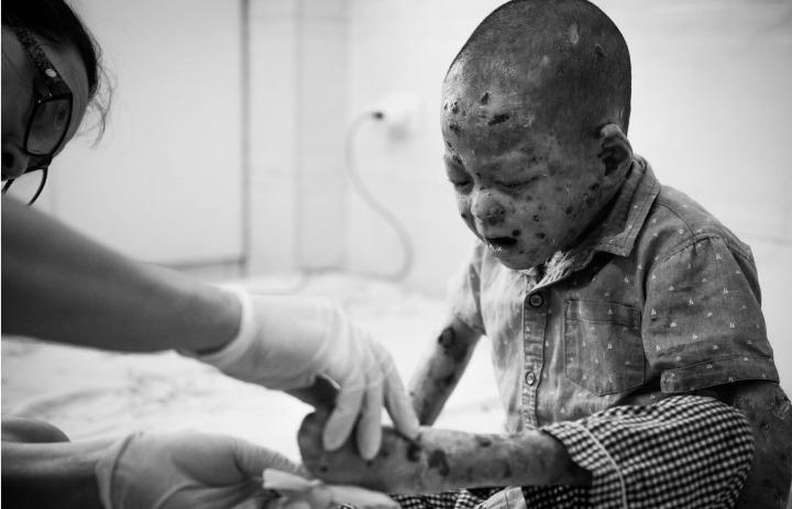 Cuộc gọi từ người lạ và hành trình 9 năm nhận nuôi em bé mắc bệnh hiếm-2