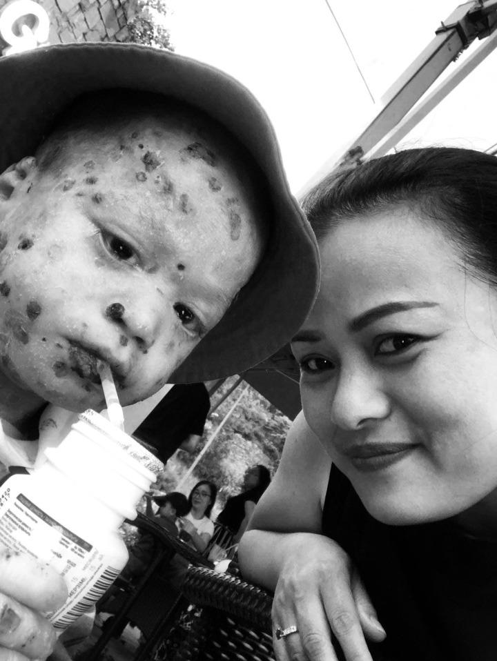 Cuộc gọi từ người lạ và hành trình 9 năm nhận nuôi em bé mắc bệnh hiếm-3