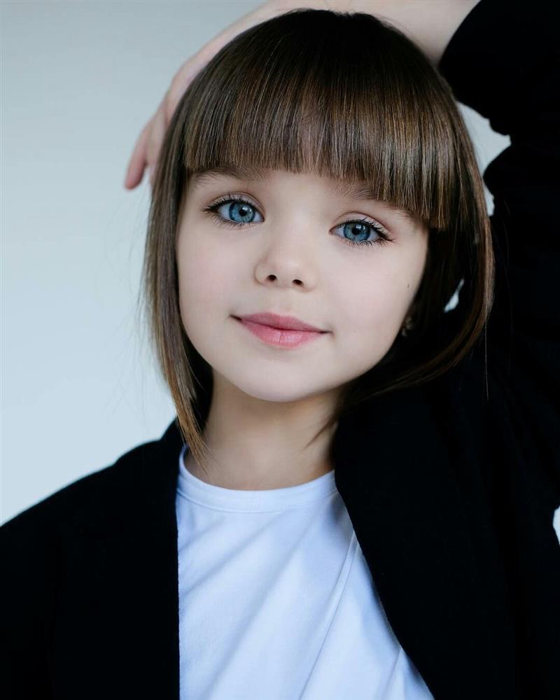 Bé gái từng gây sốt với khuôn mặt đẹp như búp bê bây giờ thế nào?-3