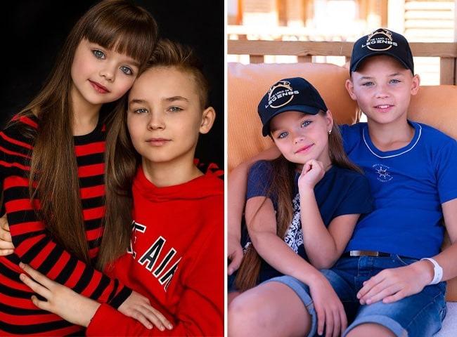 Bé gái từng gây sốt với khuôn mặt đẹp như búp bê bây giờ thế nào?-7