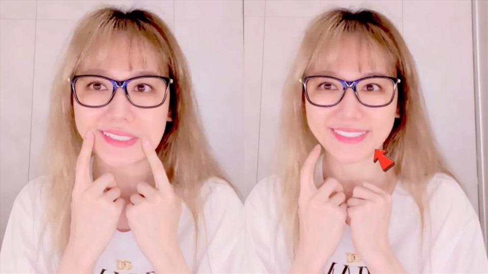 Hari Won từng bị liệt nửa mặt, tự ti không dám xuất hiện: Cảnh báo dấu hiệu bệnh và thời điểm dễ bị-2