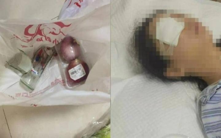 Cô gái dập nát nhãn cầu khi chai nước ngọt mua qua mạng nổ tung-1