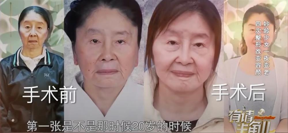 Cô gái 20 tuổi đột ngột già đi sau một đêm, chồng vẫn yêu thương, đưa đi khắp nơi chạy chữa-5