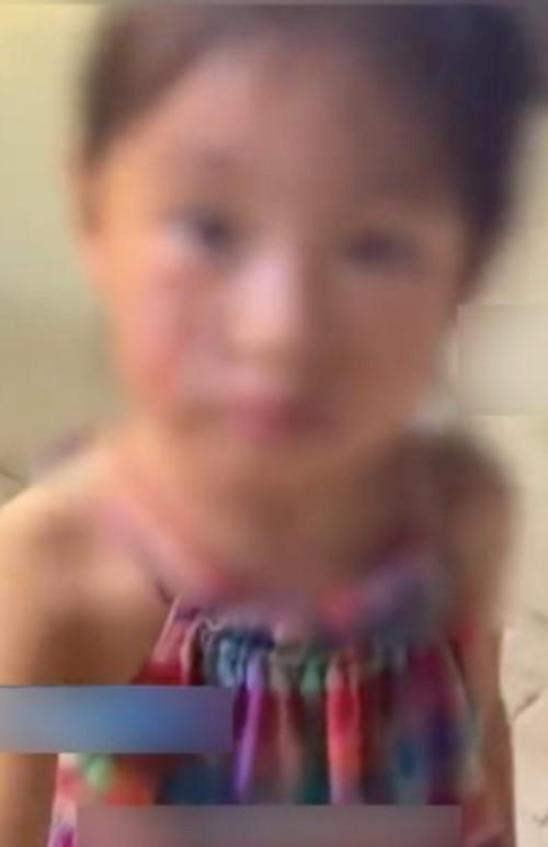 Người bán làm rơi quả sầu riêng vào mặt bé gái gây thương tích, phản ứng khó chấp nhận-2