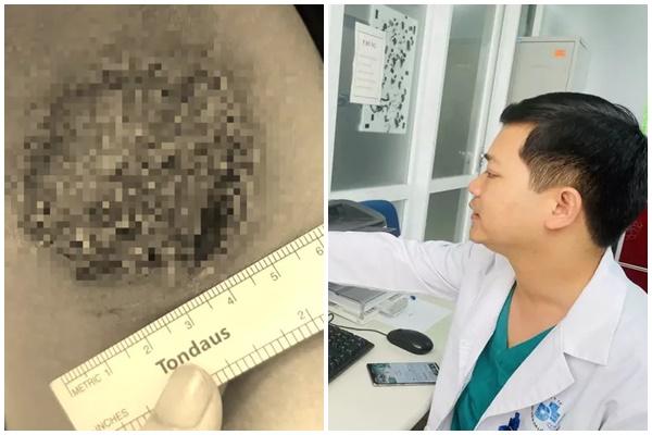 Cách chăm sóc da vùng nách-3