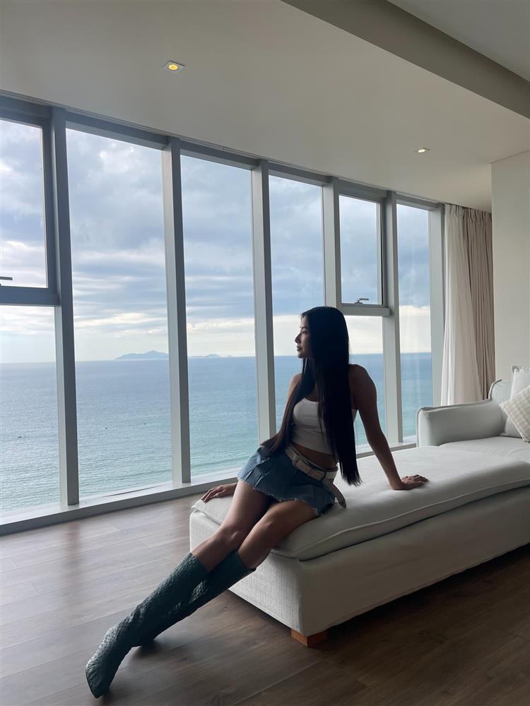 Á hậu - siêu mẫu có đôi chân lệch nhau 2 cm là ai?-4