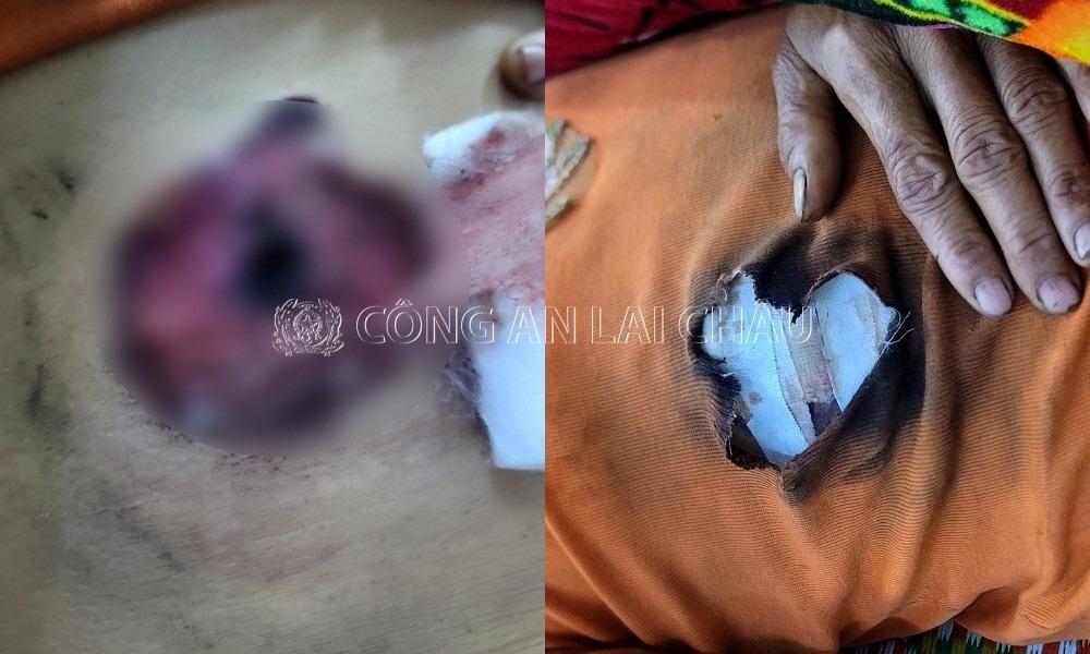 Chồng bắn vợ nhập viện vì không chịu gói bánh cúng rằm tháng 7-1