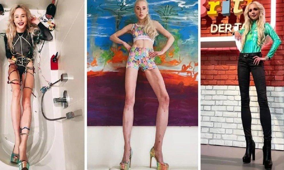 Nữ người mẫu bị chỉ trích vì chi gần 4 tỷ đồng để kéo dài chân-1