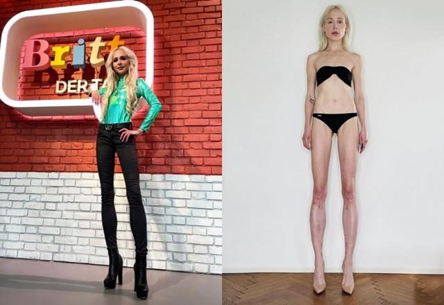 Nữ người mẫu bị chỉ trích vì chi gần 4 tỷ đồng để kéo dài chân-3