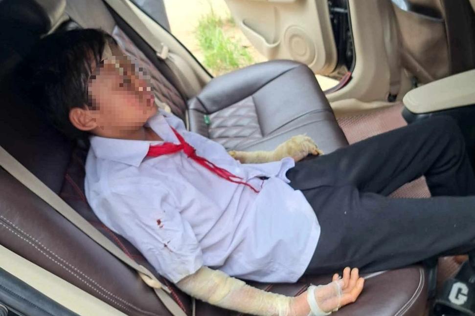 Khai giảng tại ngôi trường đặc biệt ở Hà Nội, dùng tay hát Quốc Ca-25