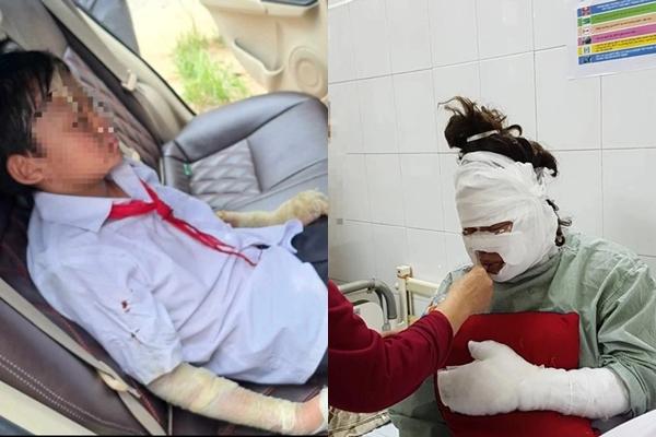 Vụ nổ bóng bay làm 10 học sinh bị thương: Thầy giáo bị phạt 350.000 đồng-2