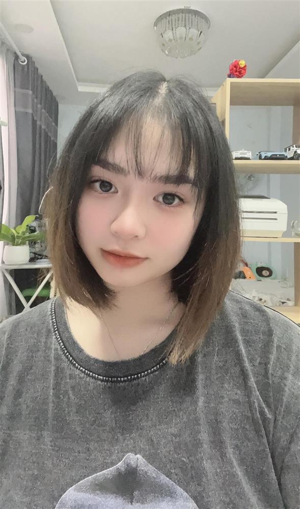 Thiện Nhân sau ồn ào với gia đình: Ngừng ca hát, vướng nghi vấn dao kéo-5