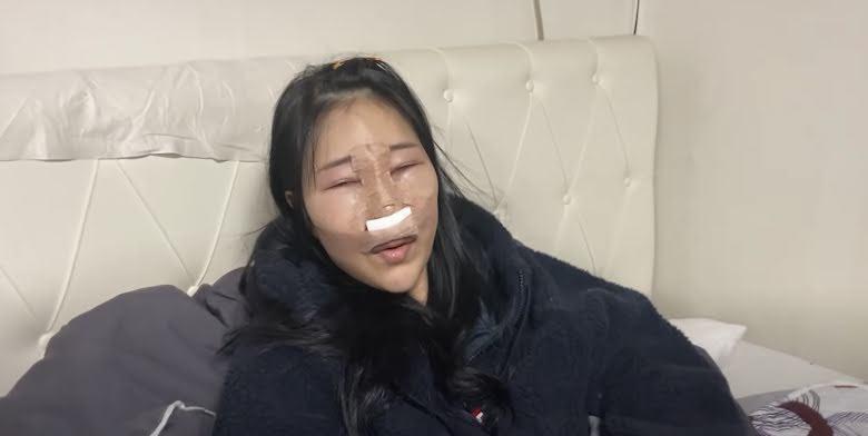 Nữ diễn viên hài đập mặt xây lại, giảm 36kg để body săn chắc, nóng bỏng-3