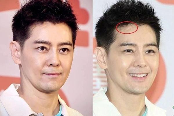 Kwon Sang Woo tuyên bố kết hôn dựa vào vẻ ngoài rất quan trọng-4