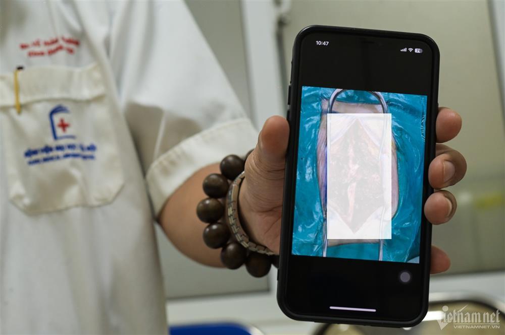 Không khí căng thẳng trong phòng phẫu thuật nạn nhân vụ cháy chung cư mini-2