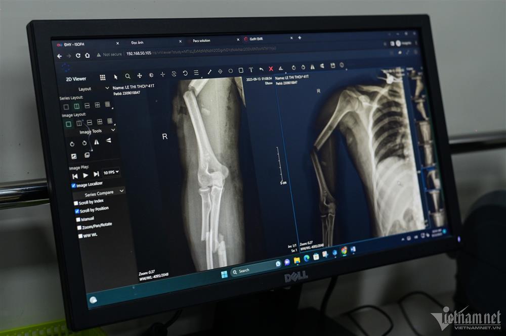 Không khí căng thẳng trong phòng phẫu thuật nạn nhân vụ cháy chung cư mini-3