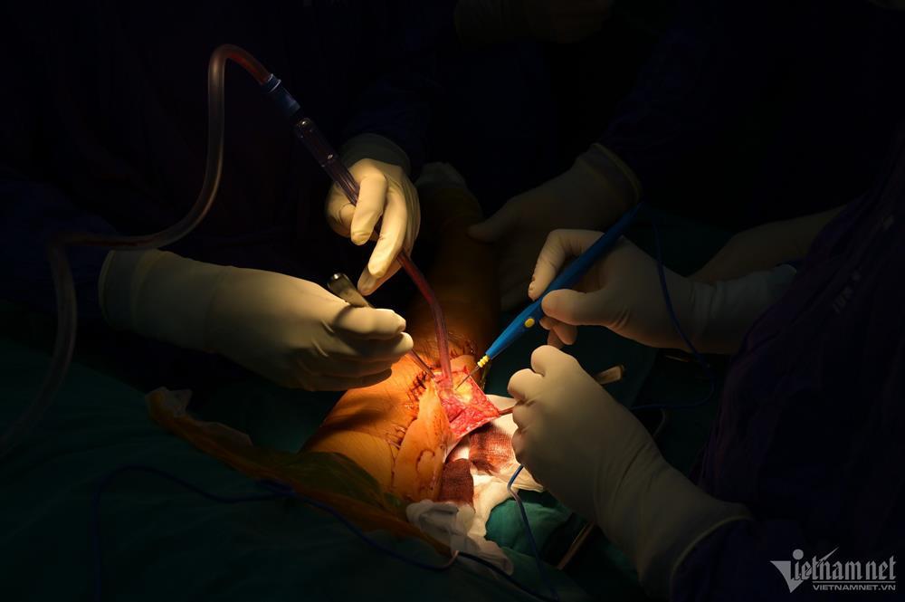 Không khí căng thẳng trong phòng phẫu thuật nạn nhân vụ cháy chung cư mini-4