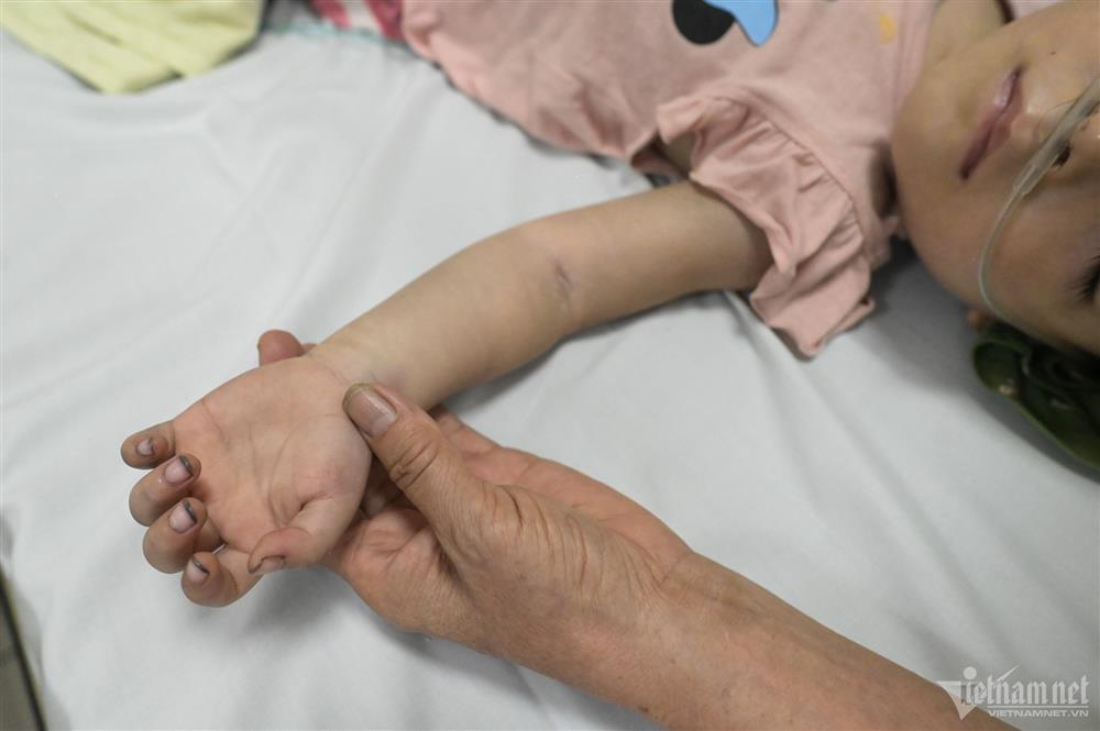 Bệnh viện lớn nhất miền Bắc bật báo động đỏ cứu nạn nhân vụ cháy chung cư mini-2