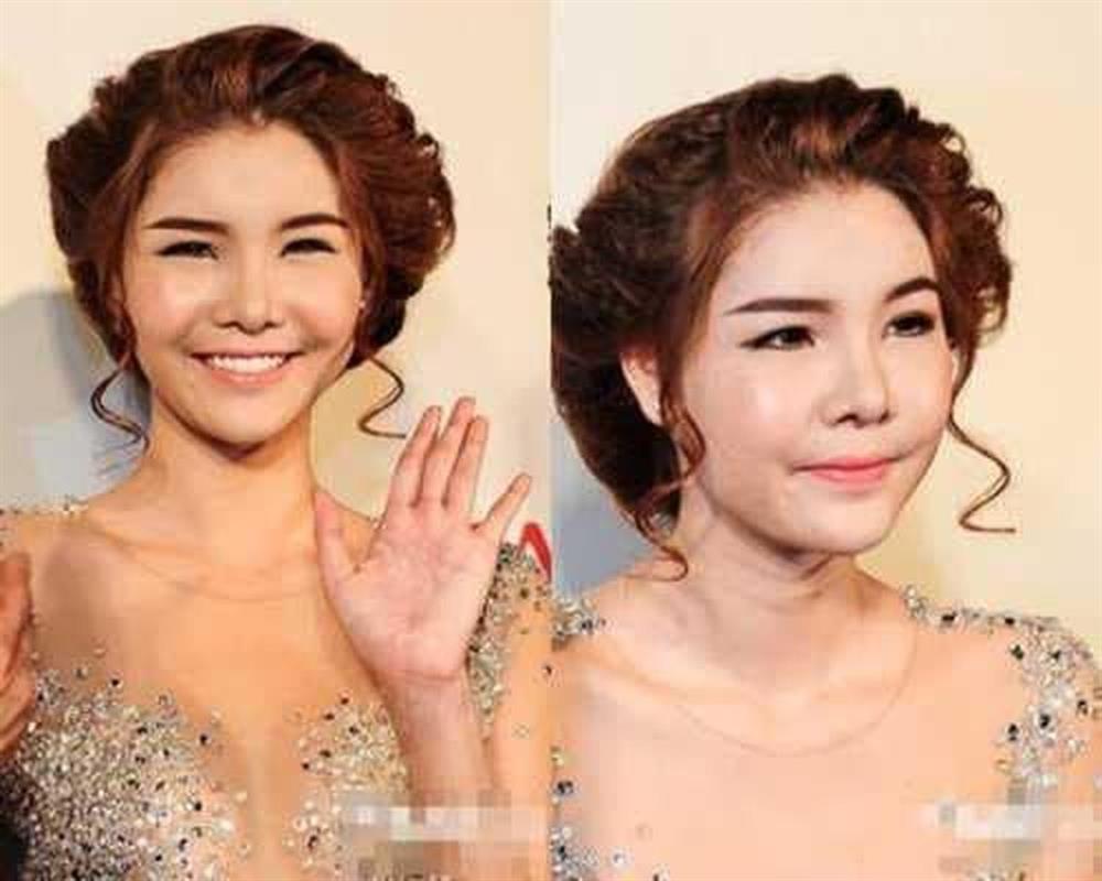 Siêu mẫu Kỳ Hân lần đầu tiết lộ khủng hoảng vì biến dạng khuôn mặt-1