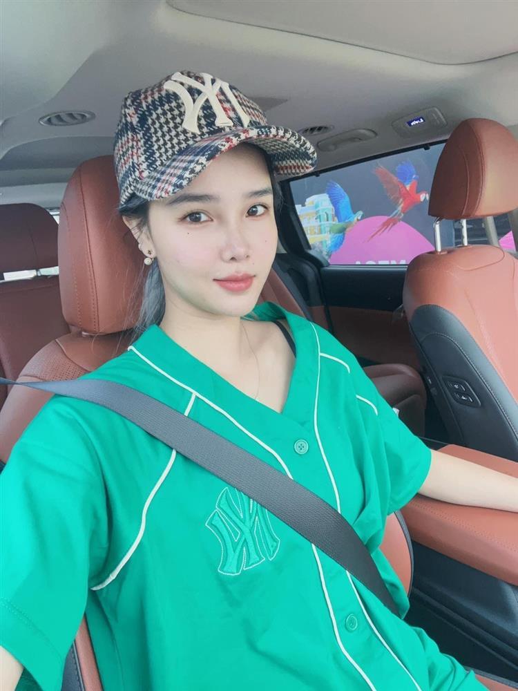 Siêu mẫu Kỳ Hân lần đầu tiết lộ khủng hoảng vì biến dạng khuôn mặt-2