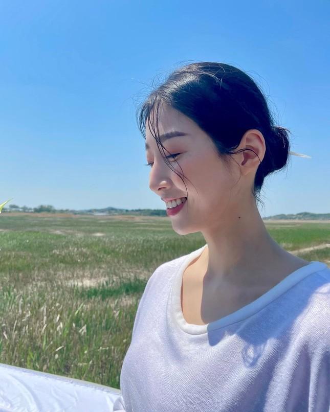 Hoa hậu bị chê béo và xấu nhất Hàn Quốc giờ ra sao?-5