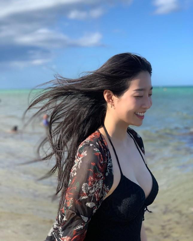 Hoa hậu bị chê béo và xấu nhất Hàn Quốc giờ ra sao?-9