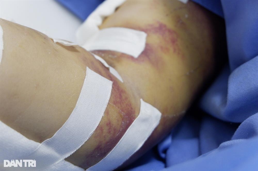 Người phụ nữ nhảy từ tầng 9 chung cư mini dần hồi phục, mong ngày gặp con-2