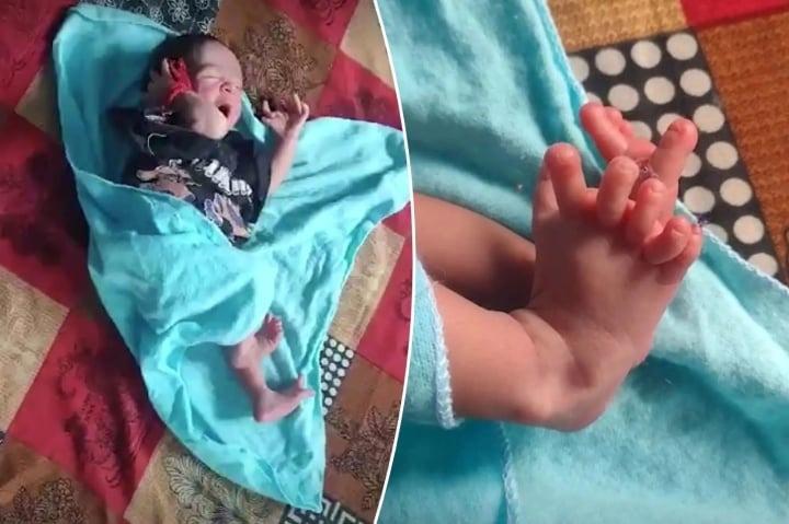 Em bé sinh ra với 26 ngón tay chân được coi là hiện thân của nữ thần Hindu-1