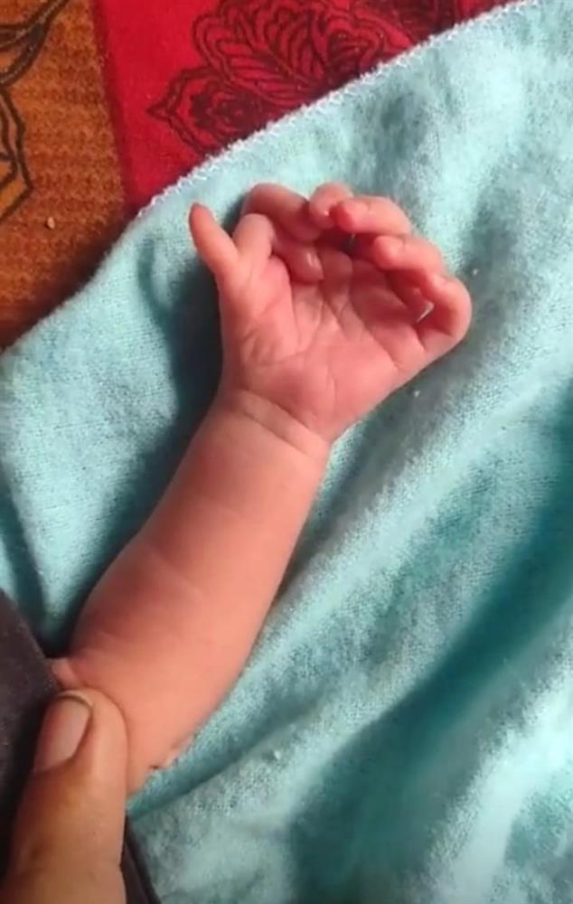 Em bé sinh ra với 26 ngón tay chân được coi là hiện thân của nữ thần Hindu-2