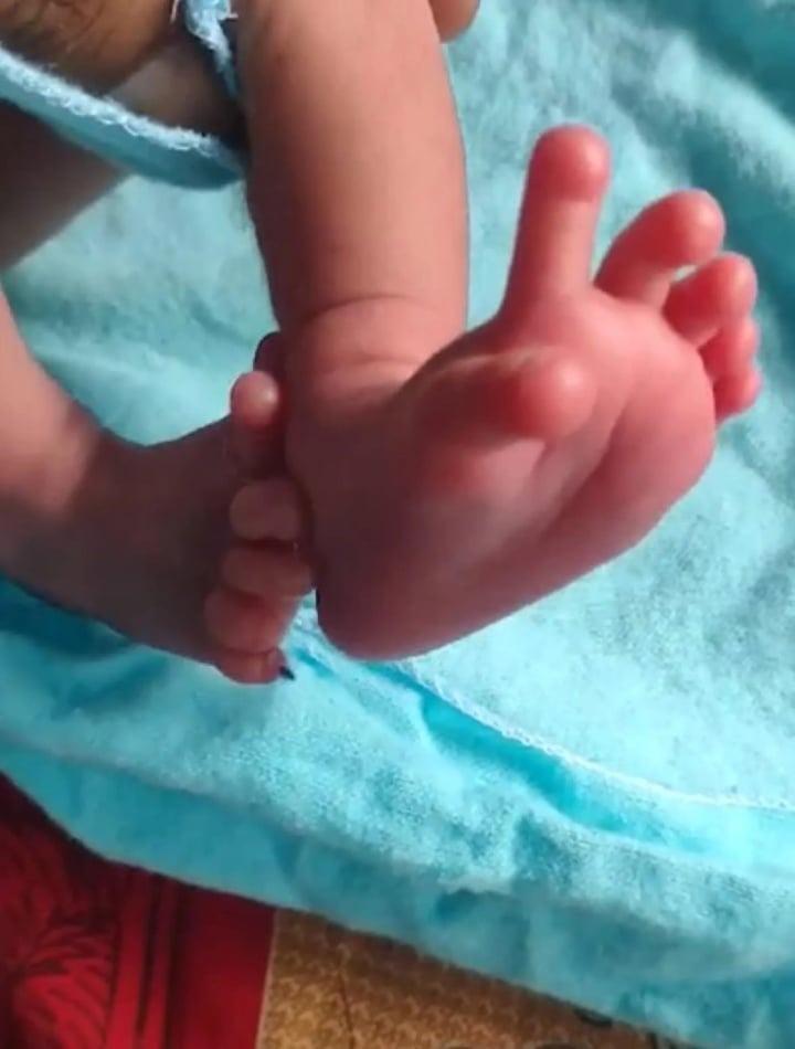 Em bé sinh ra với 26 ngón tay chân được coi là hiện thân của nữ thần Hindu-3
