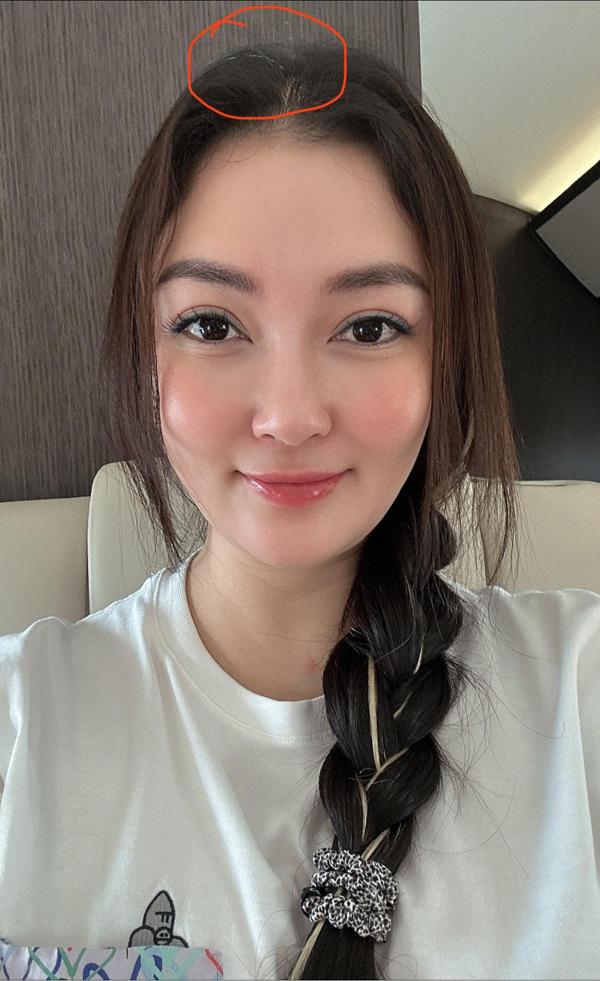 Hoa hậu Nguyễn Thị Huyền: Gương mặt từ khuôn trăng đầy đặn đến vline gây sửng sốt-4