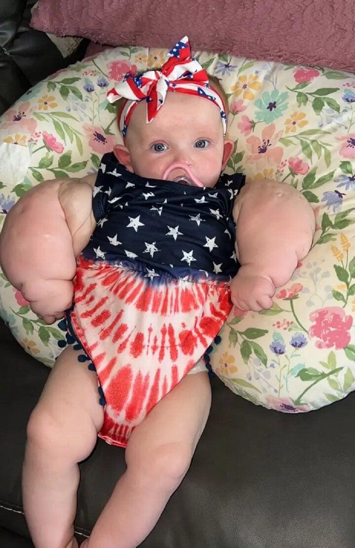 Bé gái 9 tháng tuổi có thân thể như vận động viên thể hình-2