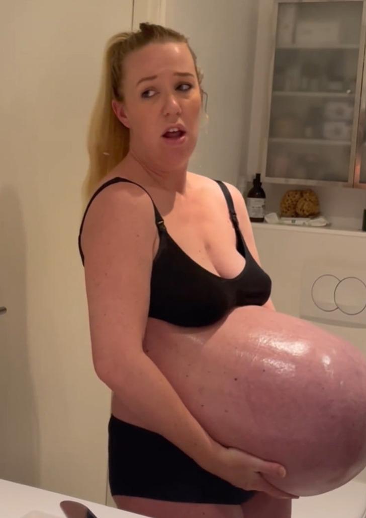 Người mẹ khoe bụng bầu như muốn nổ tung, choáng với chiếc bụng sau khi sinh-2