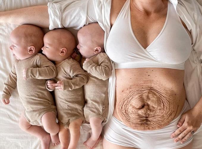 Người mẹ khoe bụng bầu như muốn nổ tung, choáng với chiếc bụng sau khi sinh-3