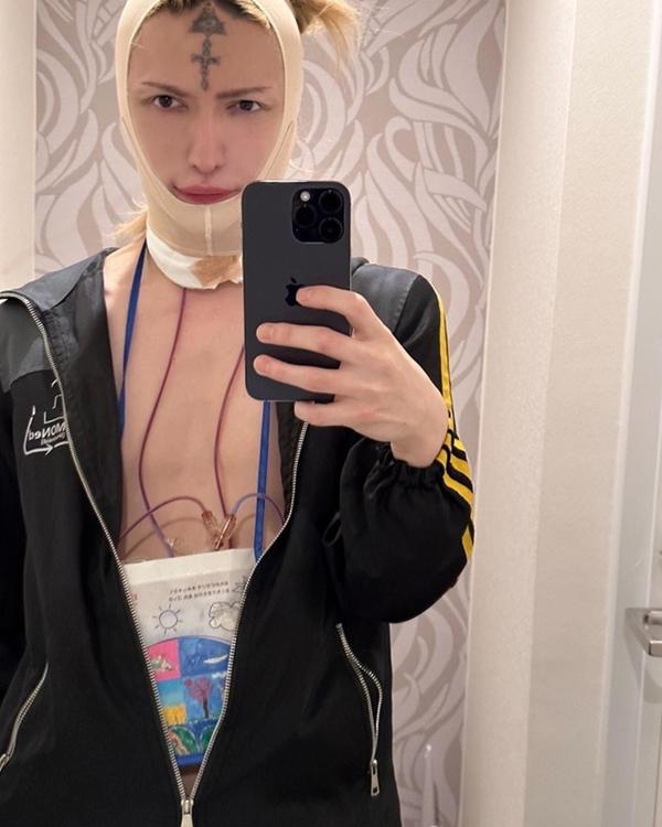 Nam ca sĩ Nhật Bản gây sốc vì cắt bỏ đầu ngực-2