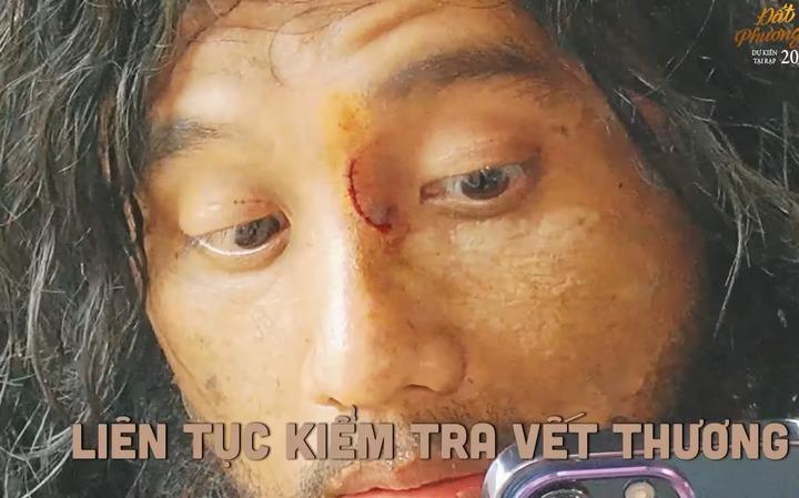Mai Tài Phến bị rách mũi trên phim trường Đất rừng phương Nam-1