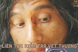 Mai Tài Phến bị rách mũi trên phim trường 'Đất rừng phương Nam'
