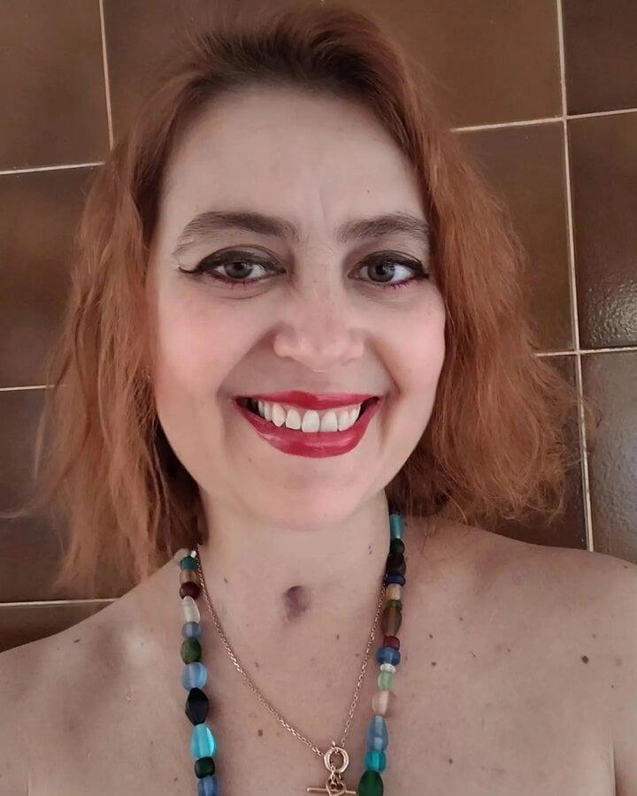 Người phụ nữ hôn mê, tê liệt toàn thân sau khi ăn đồ hộp hết hạn-1