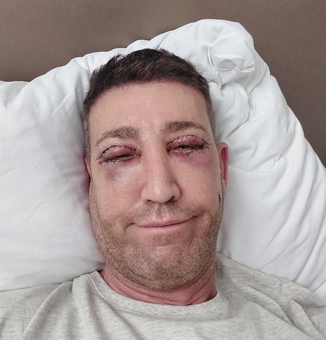 Nam ca sĩ gây choáng khi cắt bỏ bộ phận này trên cơ thể-2