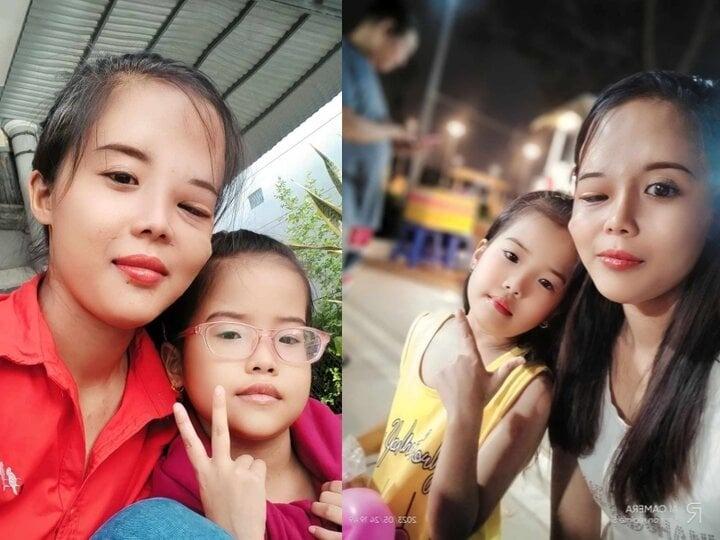 Mẹ đơn thân bị khối u nửa mặt và hành trình lột xác sau 3 cuộc đại phẫu-2