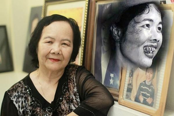 ‘Thị Nở’ Đức Lưu tuổi 85: Ngủ dậy được đấm bóp cả tiếng, sợ nhất ăn cháo hành-3