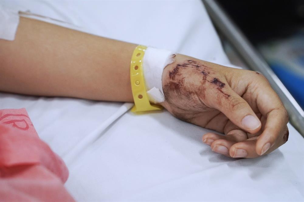 Vụ xe Thành Bưởi gây tai nạn, 4 người chết: Cô gái 24 tuổi xuất huyết não-2