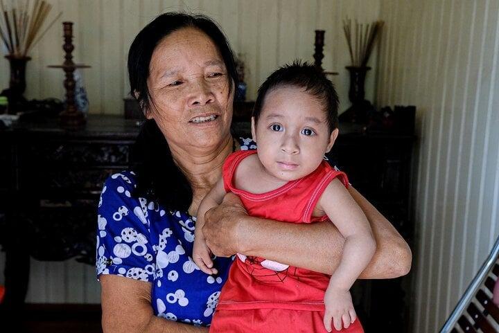 Xót xa gia cảnh hai anh em bị hội chứng người lùn đầu chim ở Thái Bình-1